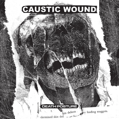 CAUSTIC WOUND - DEATH POSTURE